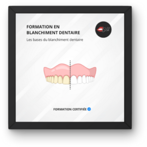 Formation blanchiment dentaire